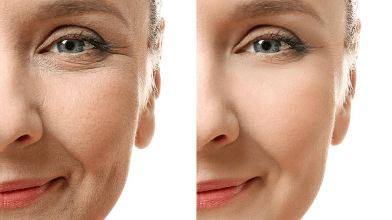 The effect of using Simpla 360 serum for aging skin